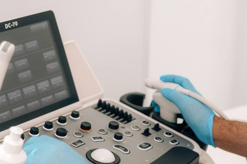 An echocardiogram (heart ultrasound) scan