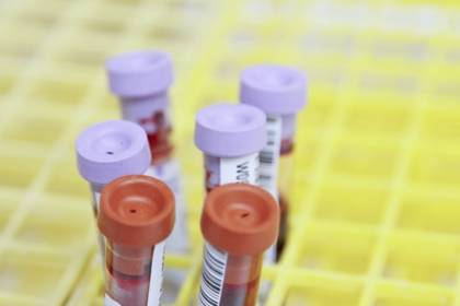 Blood sample tubes in a rack